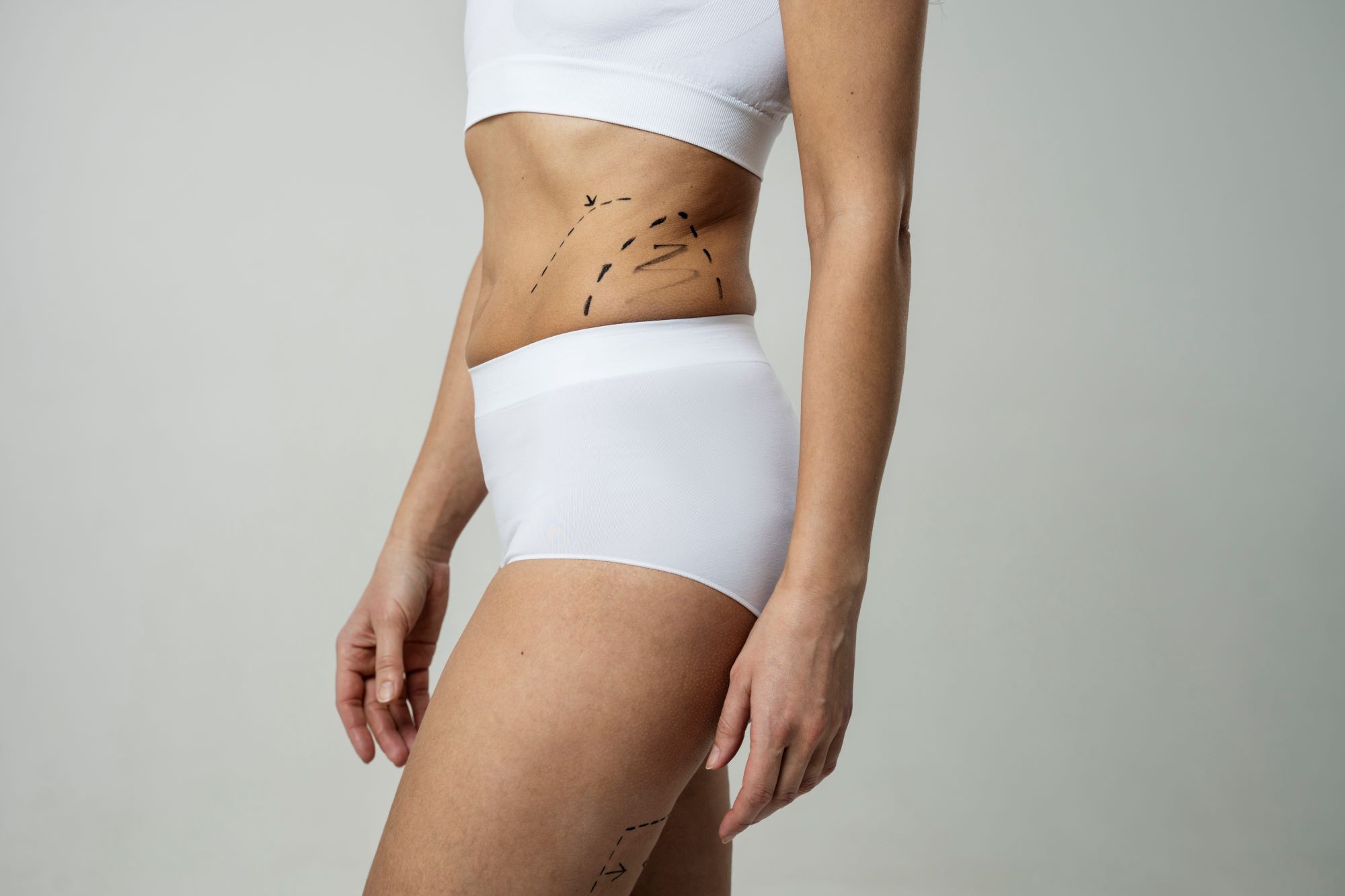 Body Contouring
